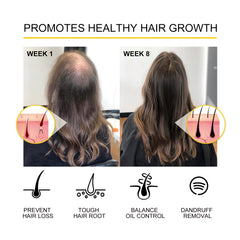 Revitalizing Hair Care Oil – Moisturize, Thicken & Restore Shine