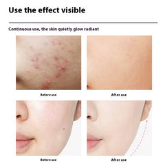 LED Photon Beauty Device – Skincare & Relaxing Facial Massage