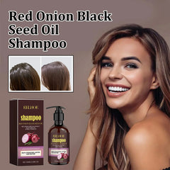 Eelhoe Hair Growth Shampoo – Red Onion Extract & Black Seed Oil Nutrition