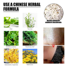 Detox Peel-Off Mask – Charcoal Facial Mask for Deep Cleansing & Smooth Skin