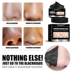 Detox Peel-Off Mask – Charcoal Facial Mask for Deep Cleansing & Smooth Skin