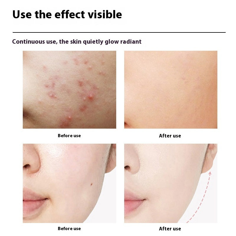 LED Photon Beauty Device – Skincare & Relaxing Facial Massage