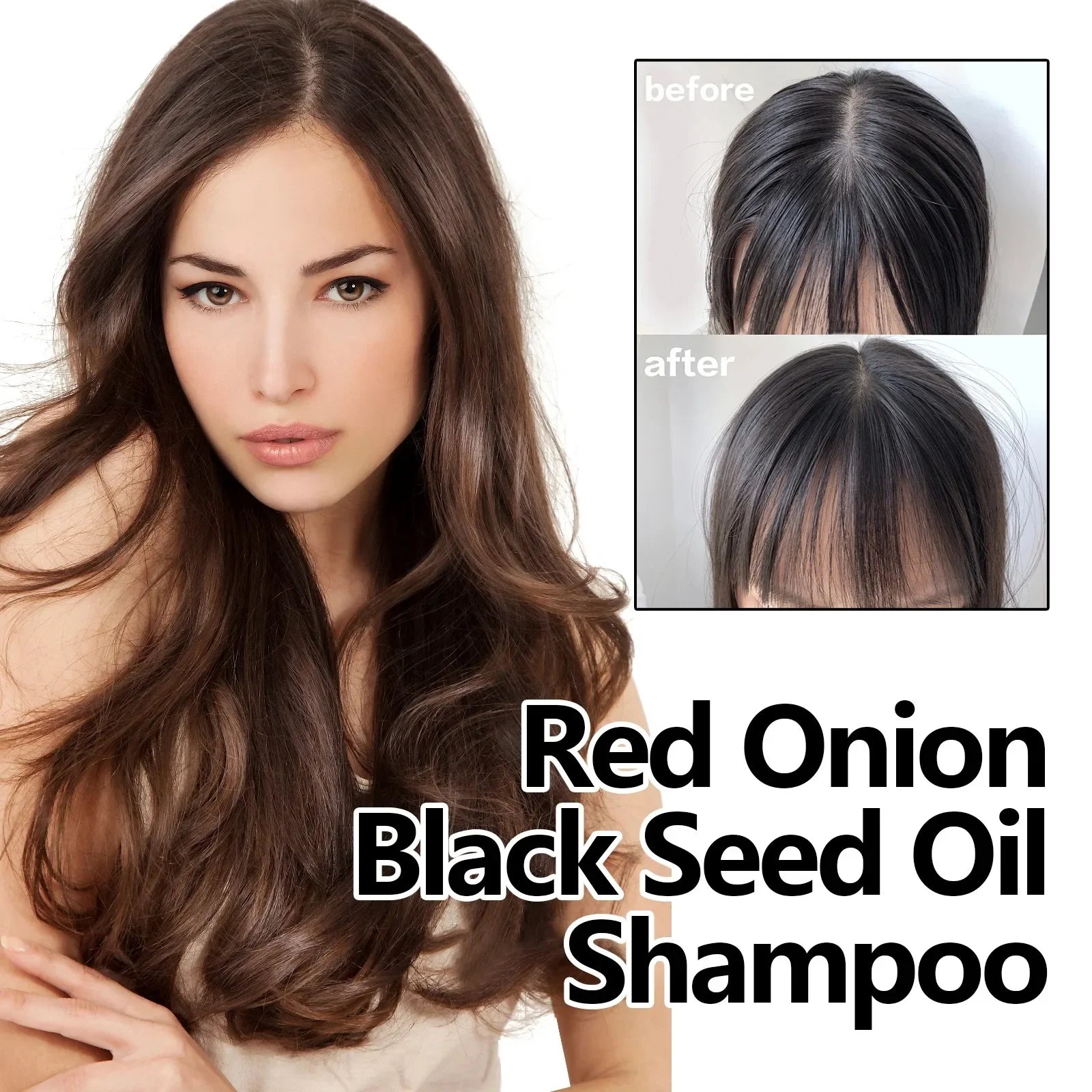 Eelhoe Hair Growth Shampoo – Red Onion Extract & Black Seed Oil Nutrition